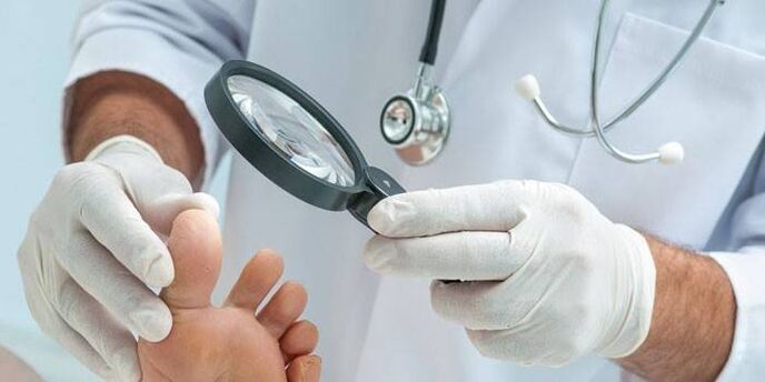doctor examines feet with warts on feet